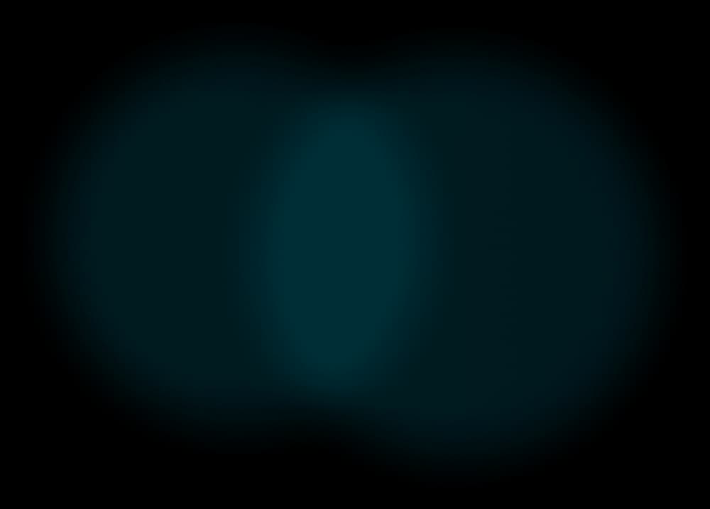 shadow
